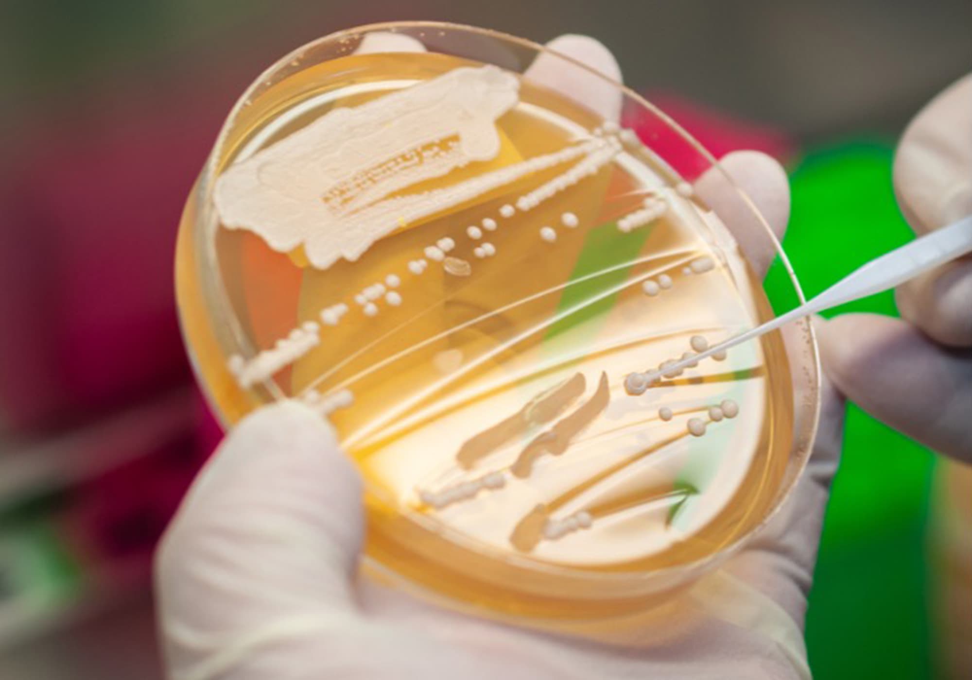 Unlocking the Benefits of Brewer’s Yeast in Distilling