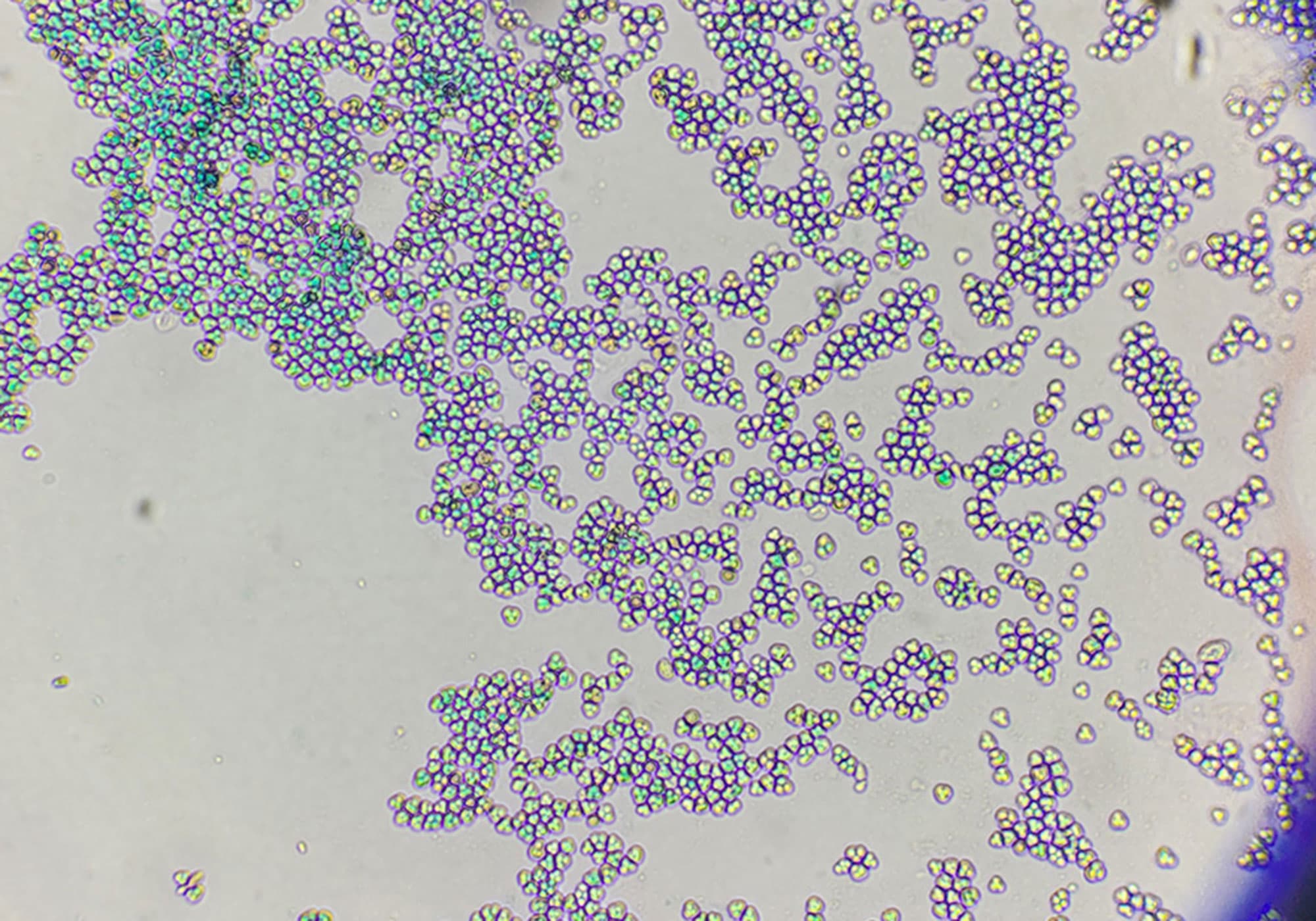 Yeast and Bacteria: Your Flavor Partners in the Distillery